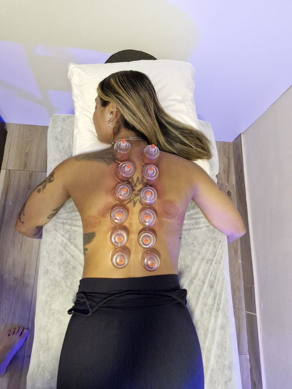 Técnica de ventosa terapia aplicada no Yoga du Ville Tijuca