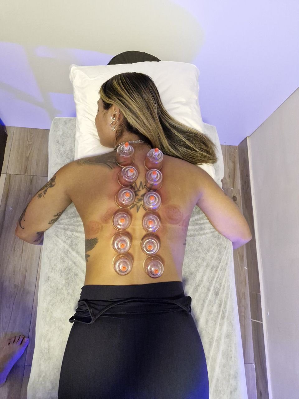 Técnica de ventosa terapia aplicada no Yoga du Ville Tijuca
